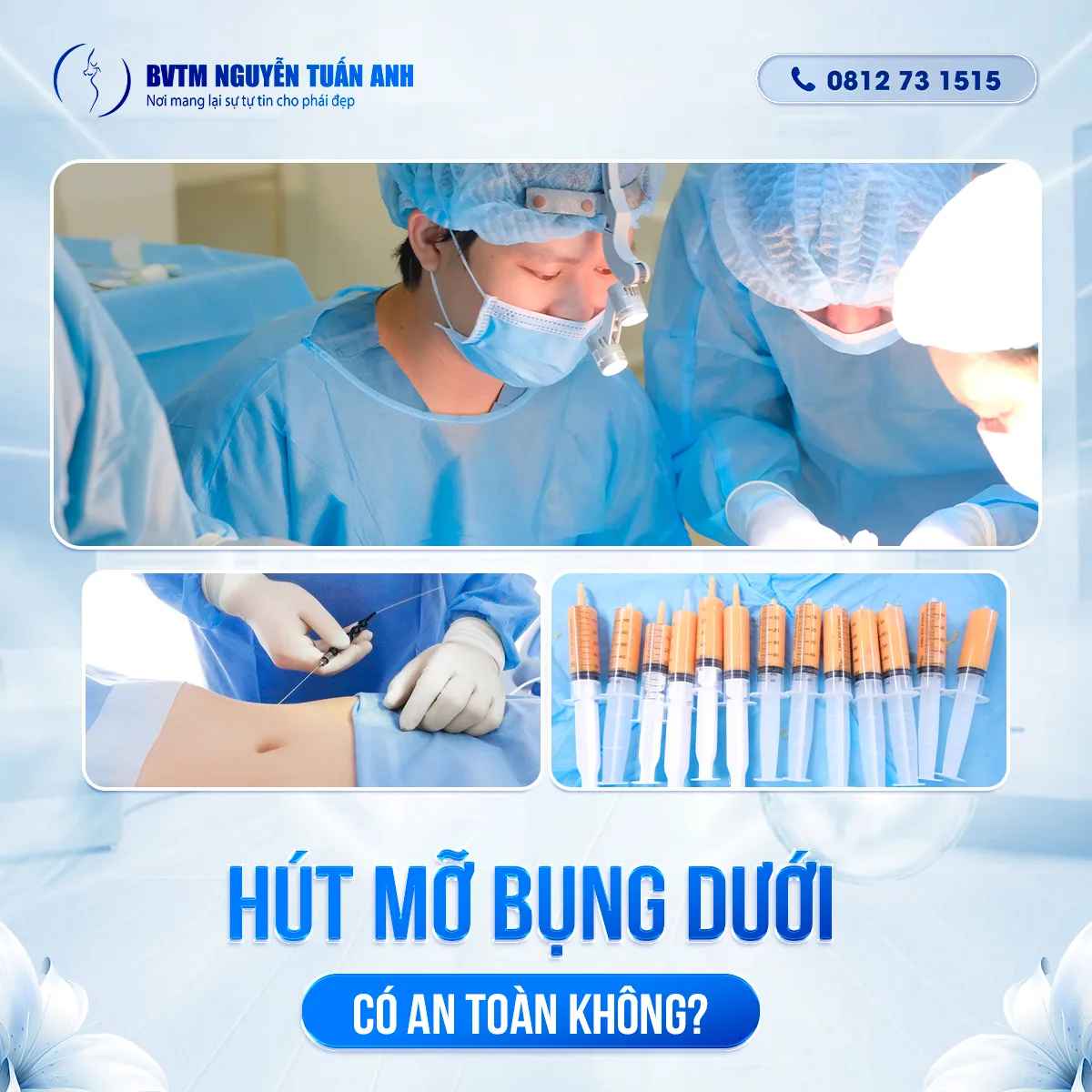 Bác Sĩ Thẩm Mỹ Nguyễn Tuấn Anh - Hút Mỡ Bụng Dưới Có An Toàn Không?