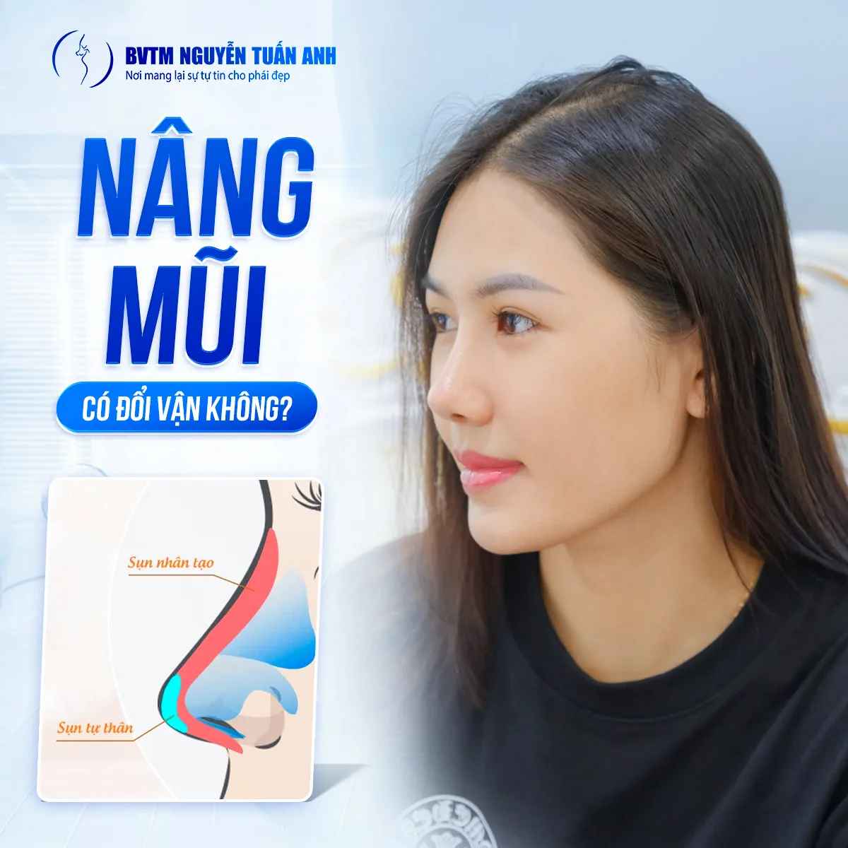 Nâng Mũi Phong Thủy Có Thật Sự Đổi Vận Không?