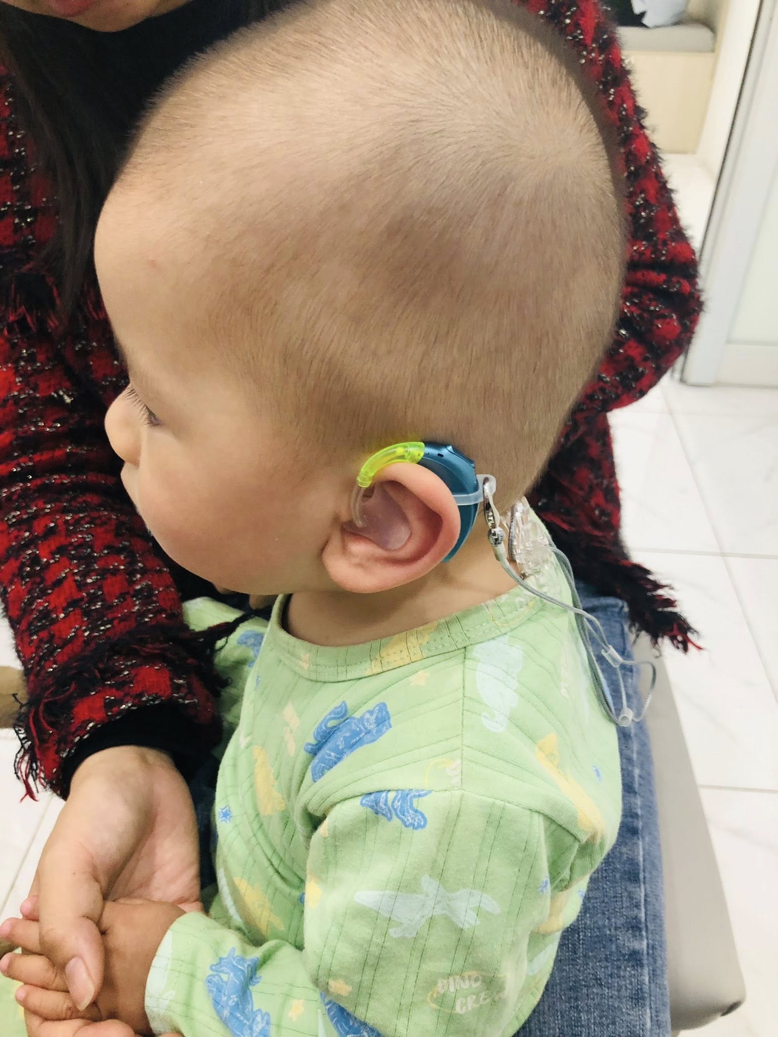 Suy giảm thính lực ảnh hưởng như nào đến trẻ tâm an quảng ninh