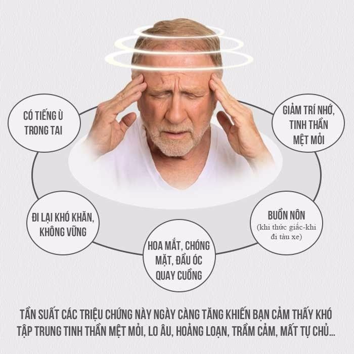 điều trị chứng rối loạn tiền đình