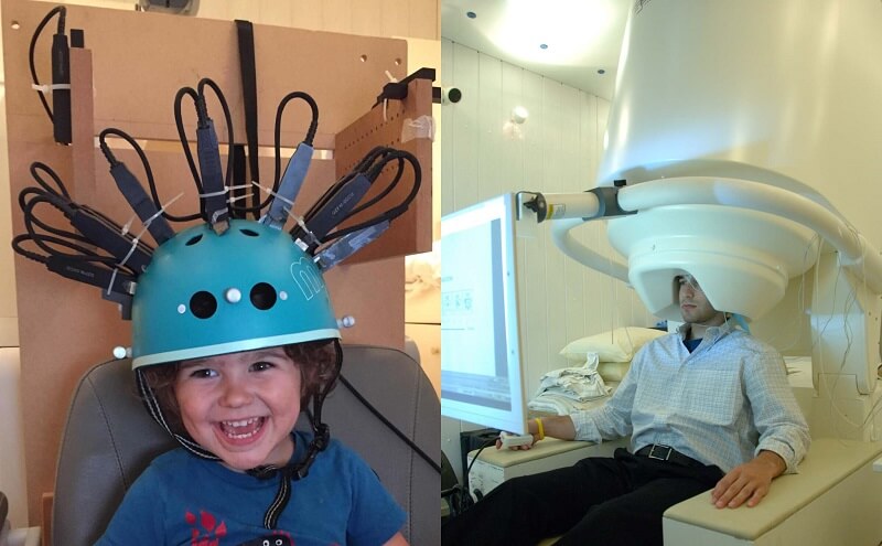 Tần số đáp ứng dùng để đo sóng não