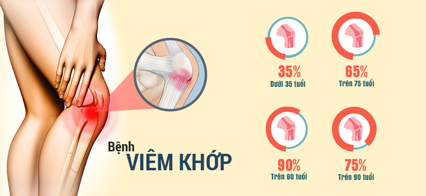 Căn bệnh tuổi già đau nhức xương khớp nguy hiểm như thế nào?