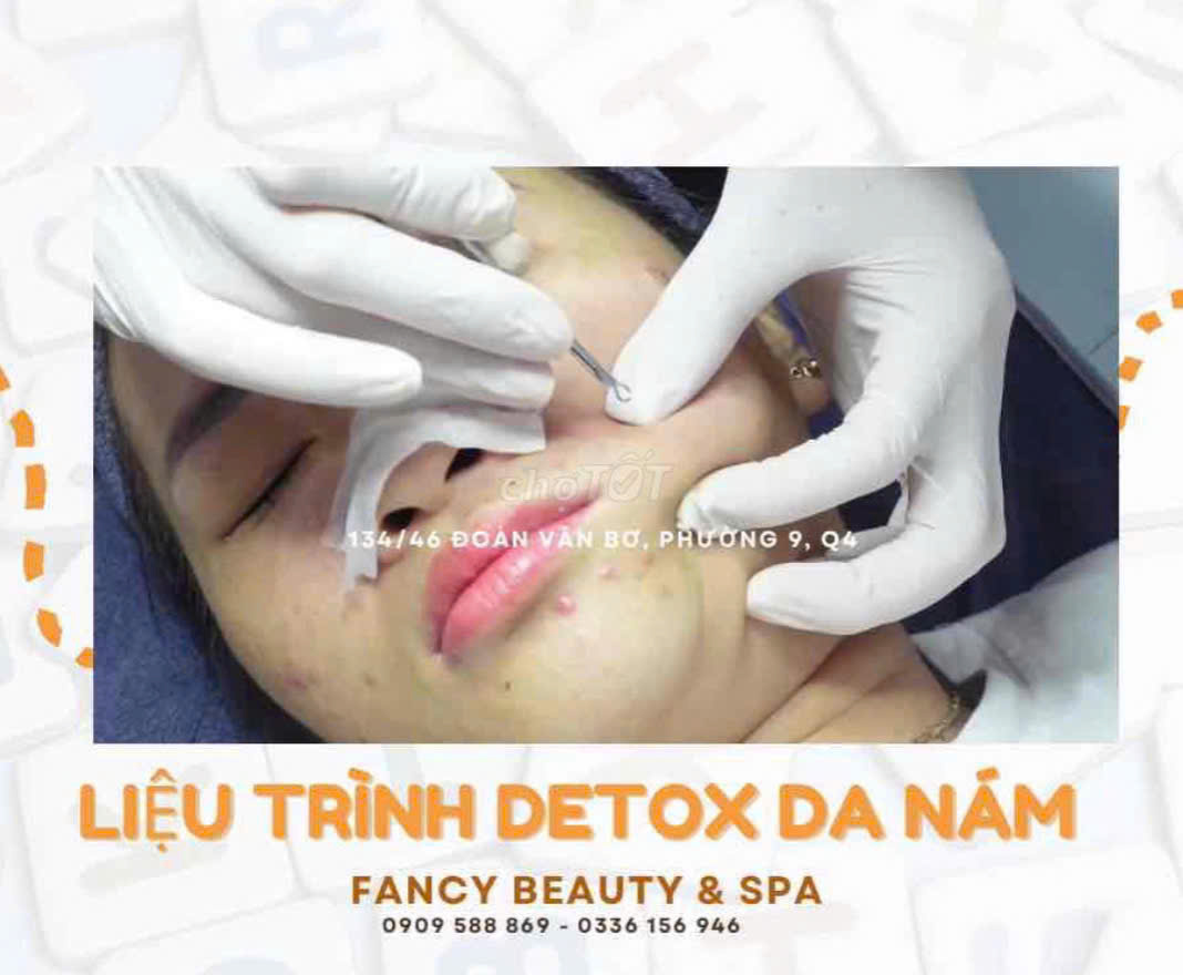 FANCY BEAUTY - SPA Q4 tuyển KTV Spa ưu tiên có KN lấy mụn